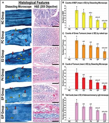 Enhanced anti-cancer effects of oestrogen and progesterone co-therapy against colorectal cancer in males